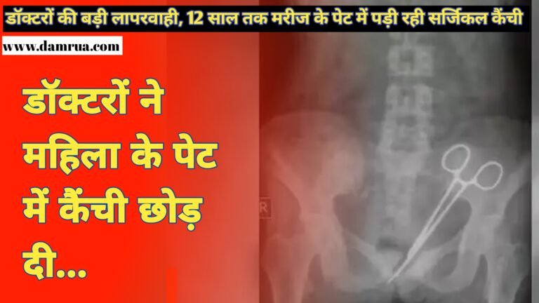 डॉक्टरों की बड़ी लापरवाही, 12 साल तक मरीज के पेट में पड़ी रही सर्जिकल कैंची