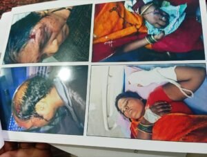 गरीब मजदूर परिवार को नहीं मिला इंसाफ गौरेला थाने से पहुंचा परिवार मजदूरों के मसीहा कहे जाने वाले इंटक जिला अध्यक्ष इदरीस अंसारी के पास 1 Screenshot 2025 05 28 10 16 08 71 99c04817c0de5652397fc8b56c3b3817