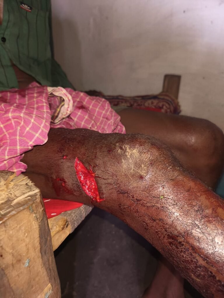 मरवाही वनमंडल के ग्राम खुरपा मे भालू का आक्रमण रिहायशी इलाकों में घुस रहा भालू