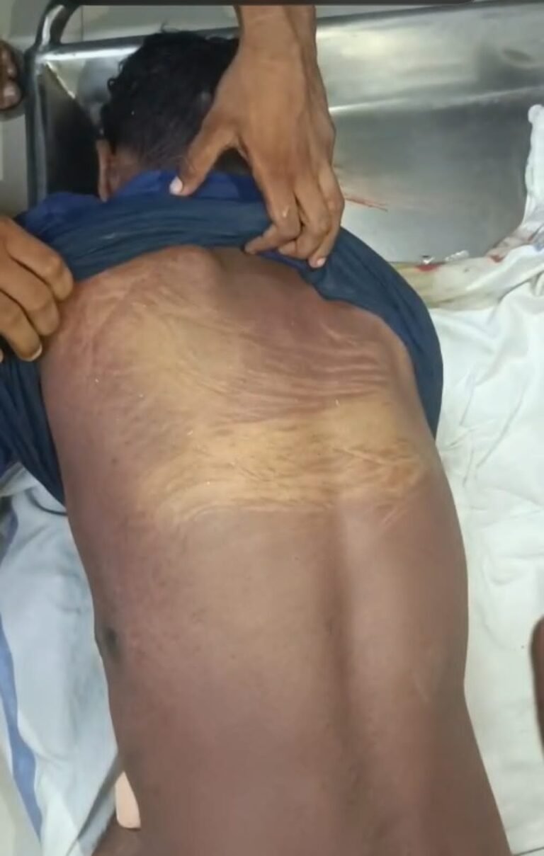 Raigarh : जेल में मौत या सिस्टम का खेल? संजय बघेल की मौत पर उठे भ्रष्टाचार और लापरवाही के सवाल